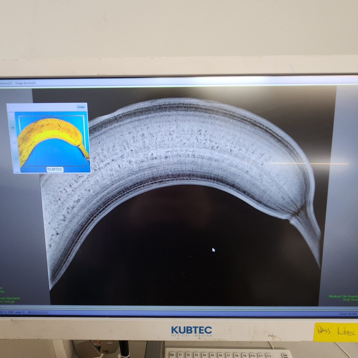 TESTED Kubtec XPERT 40 Specimen Radiography High-Resolution 2D X Image System